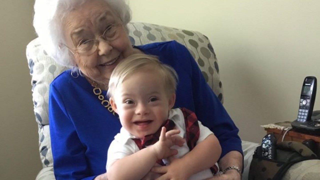 down syndrome gerber baby